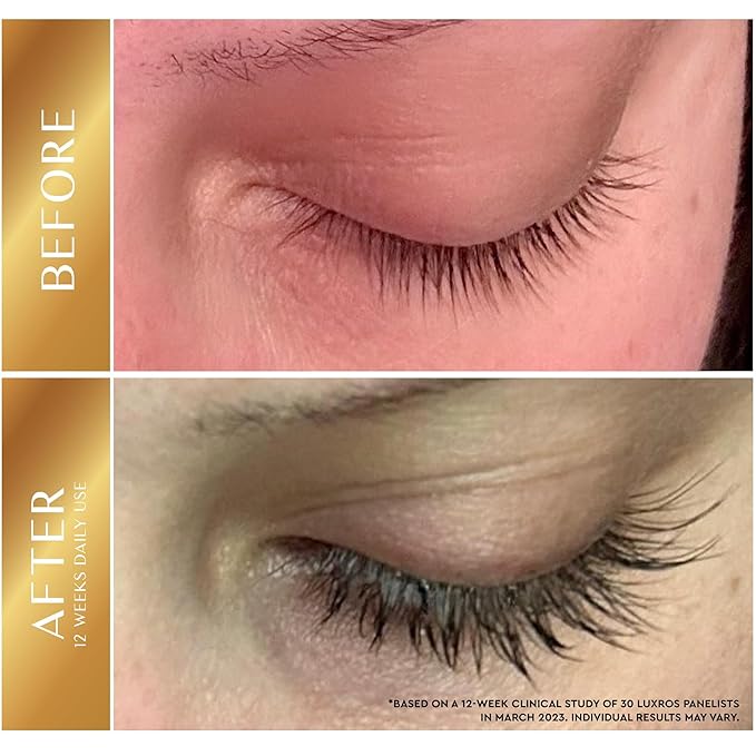 Eyelash Growth Serum 5 mL: Get Thick, Strong Lashes in Just 3-4 Weeks with Our Plant-Based Eyelash Growth Serum - No Parabens - Made in USA