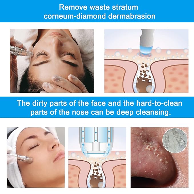 Diamond Microdermabrasion Machine Professional Dermabrasion Machine Facial Care Salon Equipment for Vacuum Blackhead Removal