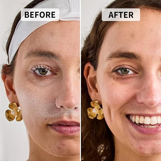 Precision Dermaplane Razor, Face Razors for Women and Men, Eyebrow Razor, Dermaplaning Tool, Peach Fuzz Remover, Skin-friendly Microblades with Protective Cap