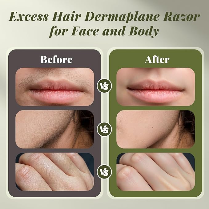 BNU Dermaplane Razor for Women, Face Razor for Women with 10 Replaceable Blades - Face Exfoliation Razor - Body Peach Fuzz Removal - Eyebrow Shaper - Sonic Edge Technology Dermaplaning Tool - Green