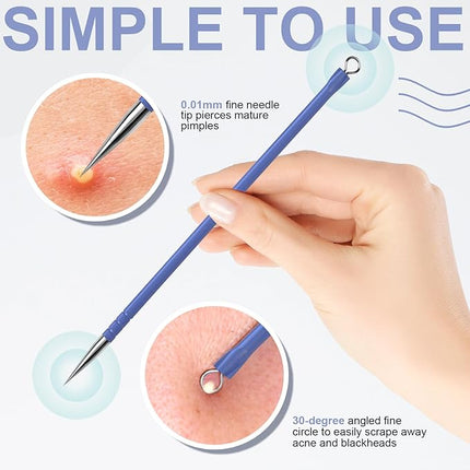 Teenitor Pimple Extractor Acne Treatment Surgical Grade Blackhead Comedone Removal 2-in-1 Popper Tool for Face Nose (Blue)
