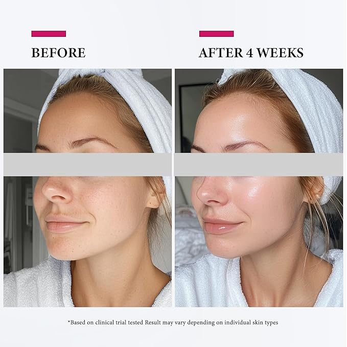 Colorfarm Facial Steamer Nano Ionic: Face Steamer Deep Cleaning Unclogs Pores - Humidifier Hot Mist Home Sauna Spa for Women Men Sinuses Moisturizing