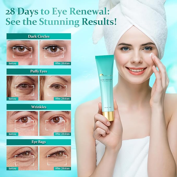 Advanced Eye Cream for Dark Circles - Rapid Under Eye Bags,Wrinkles, Puffiness Remover for Women and Men - Temporary Firming & Tightening Treatment - Wrinkle Filler 1 oz