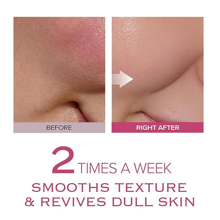 Very Berry Wash Off Pack | Korean Sauna Face Mask | Berry Complex + Fermented Ingredients for Skin Barrier | Instant Glow Up Effect | Whipped Cream Pack for Textured, Dry Skin 3.38 FL OZ