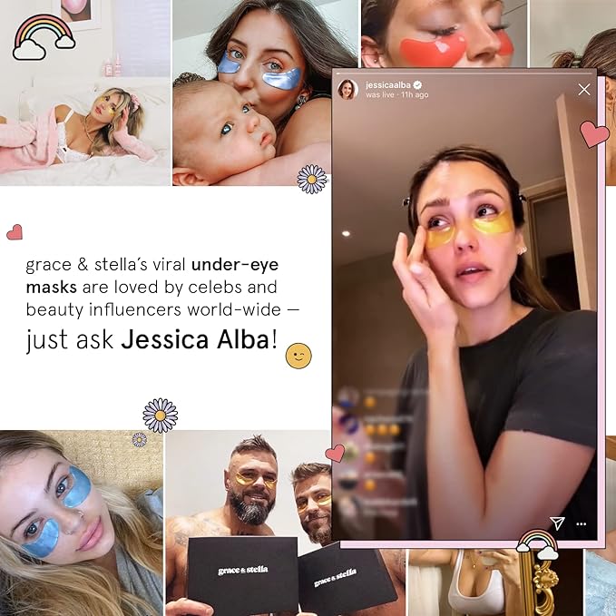 grace & stella Award Winning Under Eye Mask - Reduce Dark Circles, Puffy Eyes, Undereye Bags, Wrinkles - Gel Under Eye Patches - Gifts for Mom - Vegan Cruelty-Free Self Care (Pink, 6 Pairs)