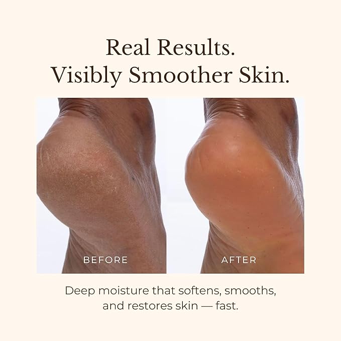 Juara - Candlenut Body Creme | Moisturizing Lotion | Dry Skin Hydration | Skin, Hands & Feet Cream | Soothing Skincare Balm | Cruelty Free, Paraben & Sulfate Free, Vegetarian | 7.5 oz (2-Pack)