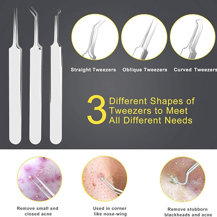 Pimple Popper Tool Kit - Boxoyx 10 Pcs Blackhead Remover Comedone Extractor Kit with Metal Case for Quick and Easy Removal of Pimples, Blackheads, Zit Removing, Forehead,Facial and Nose(Silver)