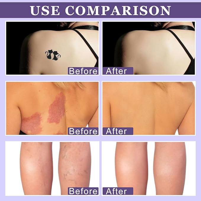 2 Pcs All Over Complexion Perfector, Body Coverage Perfector, Tattoo Cover Up Makeup Waterproof, Transfer-Resistant Body Makeup, Cream Body Makeup, Long Last Body Foundation