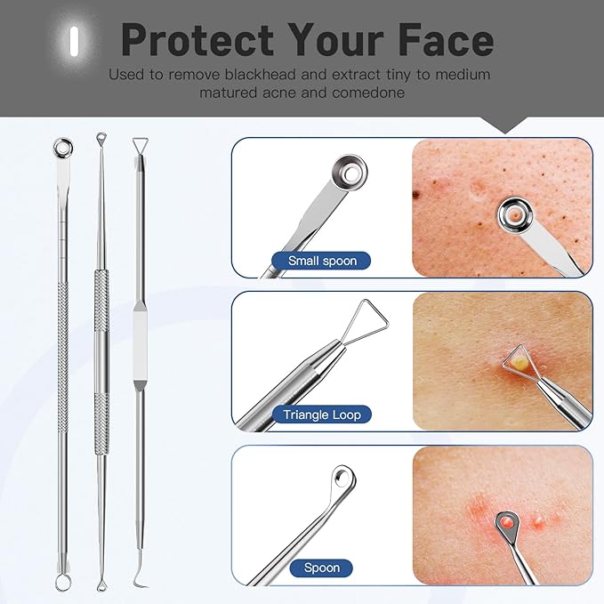 Professional Pimple Popper Tool Kit,10 PCS Blackhead Remover Kit,Extractor Acne Removal Kit for Easy Removal for Pimples,Comedone Extractor Tools for Removing Zit,Acne Removal Kit (Silver)