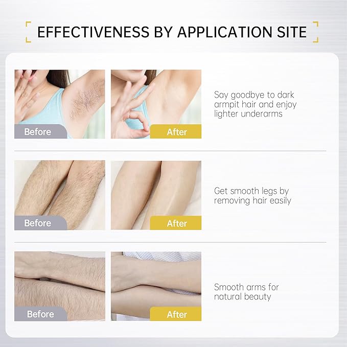 VGO Painless Hair Removal Lotion for Women & Men - For Unwanted Hair, All Skin Types, White, 4.02 oz