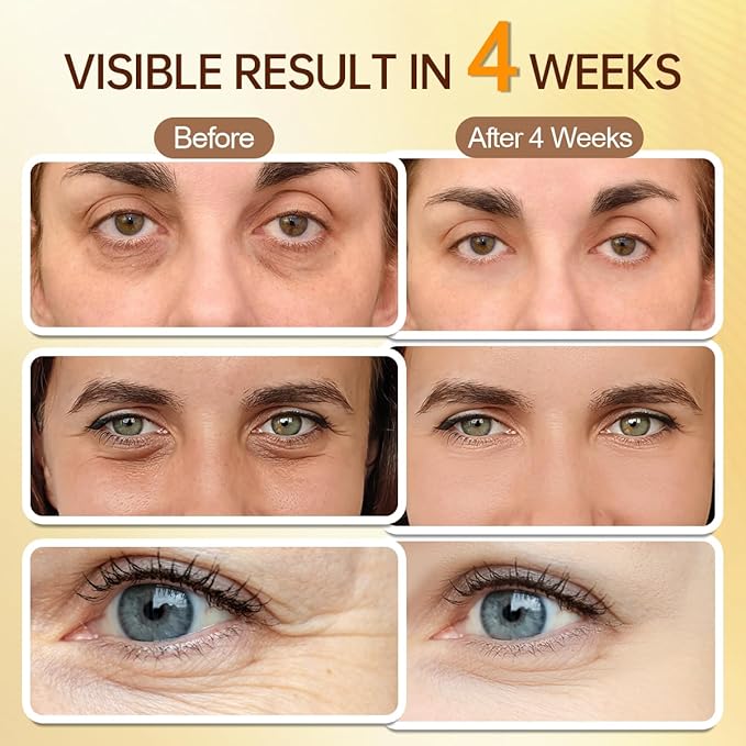 5% Caffeine Eye Serum Roller, Eye Cream for Dark Circles & Wrinkles - with Retinal Hyaluronic Acid, Instant Depuffing Eyelid Lift, 0.51 fl oz