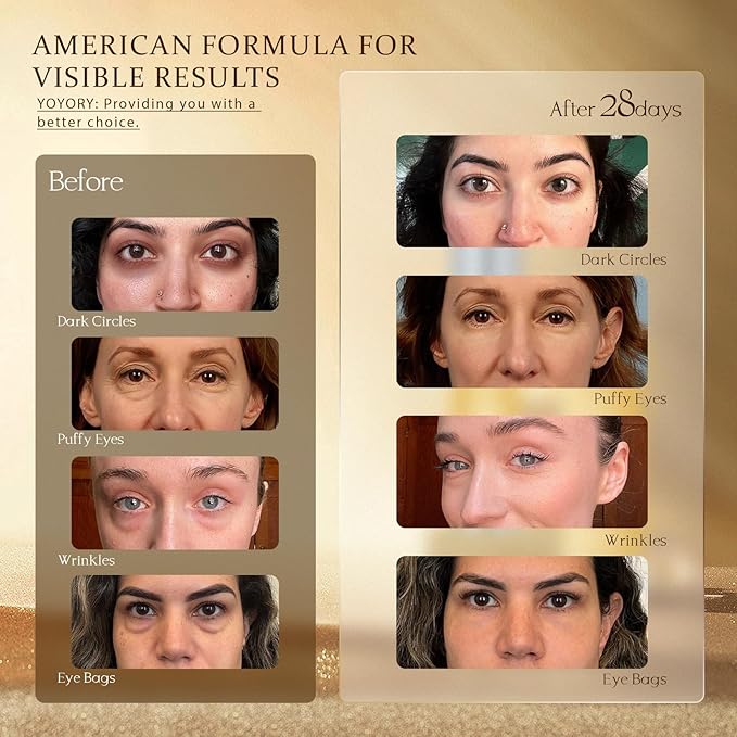 Retinol Under Eye Cream - Anti Aging Eye Cream for Dark Circles and Puffiness, Eye Bags, Wrinkles Fine Lines Skin Care Treatment Firming & Lifts for Man and Women - Gold 20ml