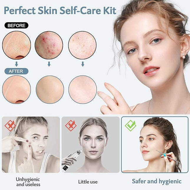 MENOLY Pimple Popper Tool Kit 10 Pcs Blackhead Remover Tool Zit Popper for Blemish, Pimple Comedone Extractor Acne Tool for Blackheads, Acnes, Whiteheads Nose Face with Leather Bag