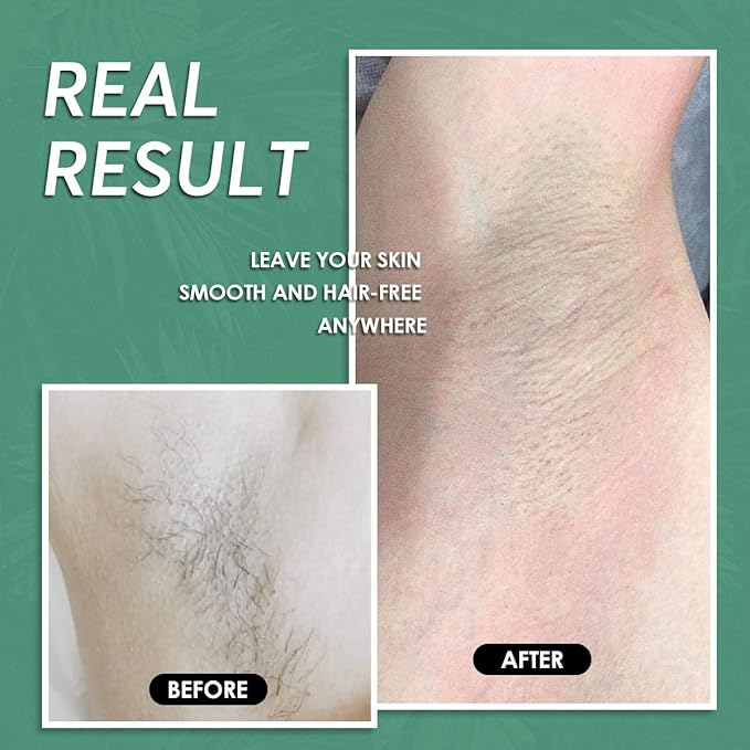 Maxpearl Wax Beads for Hair Removal, 2.5lb Hard Wax Beans Refill Bag for Brazilian Bikini, Face, Eyebrows, Underarms, Arms, Chest, Back, Legs, Coarse Body Hair Specific