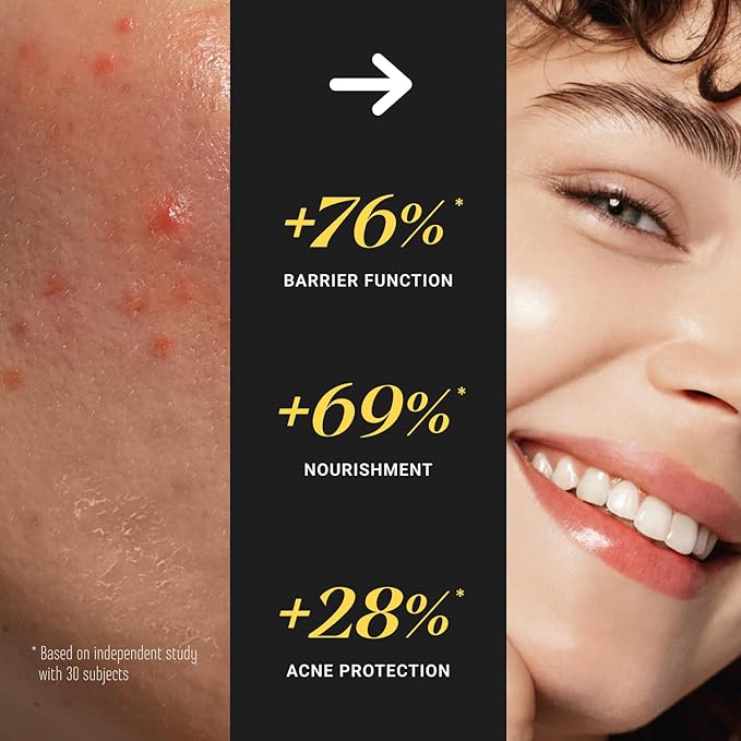 Non-Greasy Beef Tallow for Face Moisturizer Cream 5OZ Shea Butter, Vitamin E, Whipped Grass Fed Beef Tallow for Skin, Body, Hair, Lotion for Women & Men, Anti-Aging Face Moisturizer