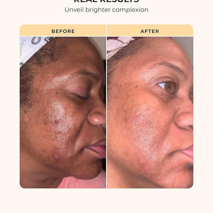 Buttah Skin Transforming Kit for Melanin Rich Skin | CocoShea Revitalizing Cream 2 oz | Vitamin C Serum 1 oz | Buttah Cleanser 3.4 oz | Black Owned Skincare