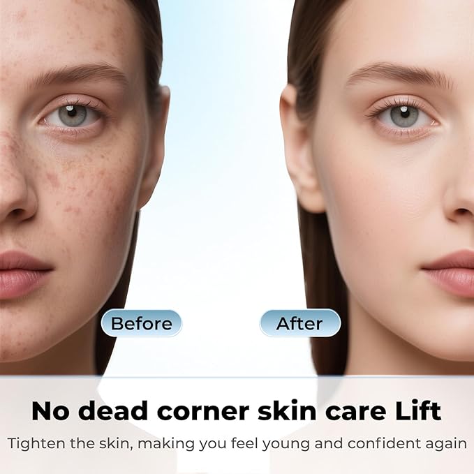 Blackhead Remover Tool Face Scrubber: PETYDOOT Double-Headed Face Spatula Skin Scrubber, Nose Pore Cleaner Blackhead Remover for Facial Deep Cleansing Skin Care Tool for Men & Women(Purple)