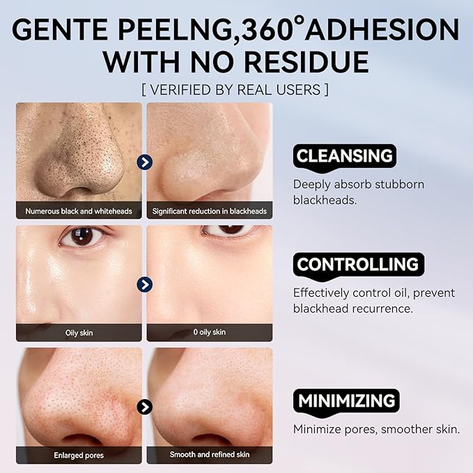 LANBENA 3-in-1 Blackhead Removal Set - Pore Strips (30g), Pore Minimizing Serum (30ml) & Removal Paper - Mask for Face, Minimizes Pores & Leaves Skin Fresh & Clean, Blackhead Remover