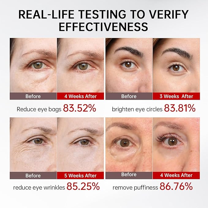 Retinol & Caffeine Eye Serum -360° Massage Roller for Puffiness,Eyebag Remover,Wrinkle Filler,Under Eye Cream For Dark Circles 0.54fl.oz (Pack of 1)