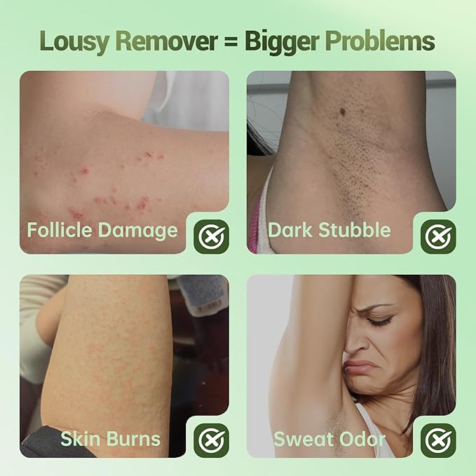 Hair Removal Cream For Women - Painless Body Hair Remover Sensitive Skin Hair Removal For Back Legs Fast And Gentle 3.38 Fl Oz