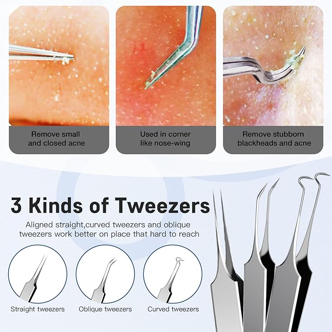 Professional Pimple Popper Tool Kit,10 PCS Blackhead Remover Kit,Extractor Acne Removal Kit for Easy Removal for Pimples,Comedone Extractor Tools for Removing Zit,Acne Removal Kit (Silver)