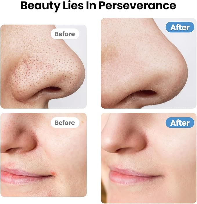 UNIWA Skin Scrubber Face Spatula, Skin Scrubber Pore Cleaner Blackhead Remover Tool for Deep Facial Cleansing - 4 Modes, Face Spatula with USB Charger, LCD Display, IPX7 Waterproof -Green