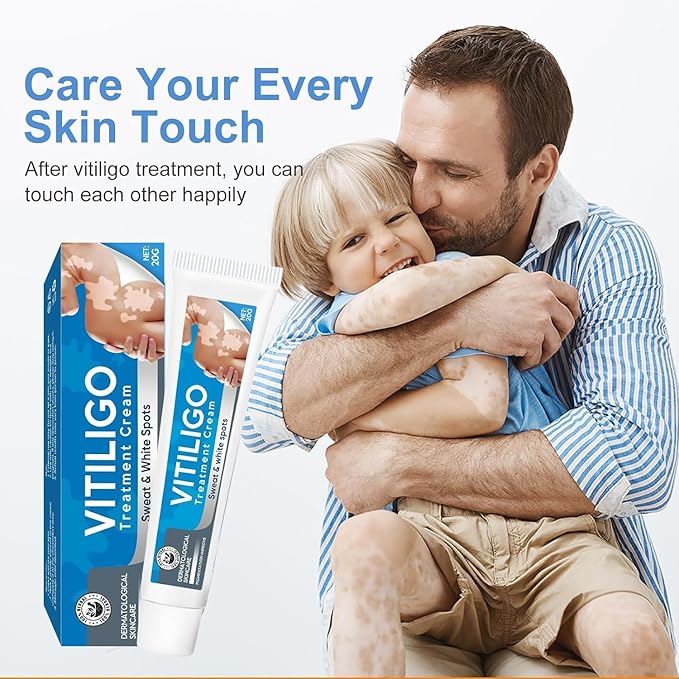 Vitiligo Cream, Natural Vitiligo Treatment Cream for Skin Vitiligo, Suitable for Skin Vitiligo, Leukoplakia, Suitable for Men and Women