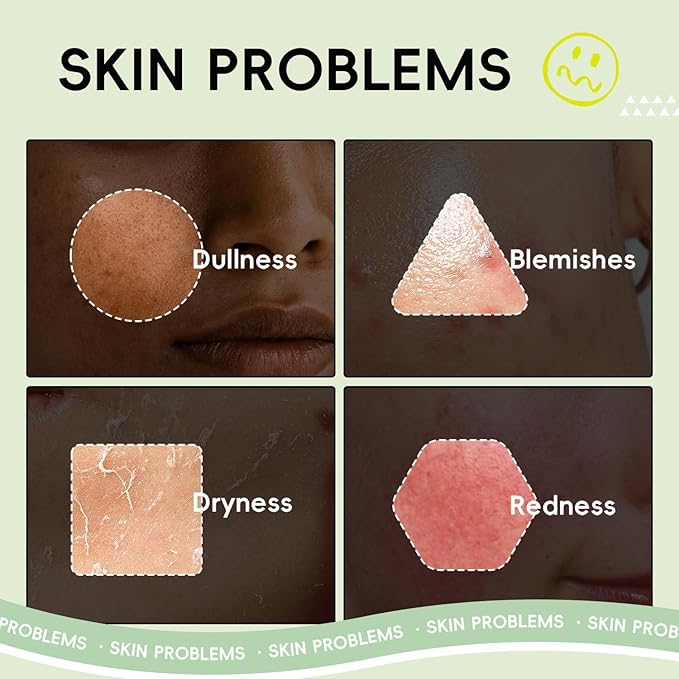 Fruit Skincare, Skin Care Gift Sets, Skin Care for Teens 10-12, with Lip Balm *6, Facial Cleanser, Toner, Serum, Eye & Face Cream, Nourishing, Hydration, Glow Up, Trendy Stuff