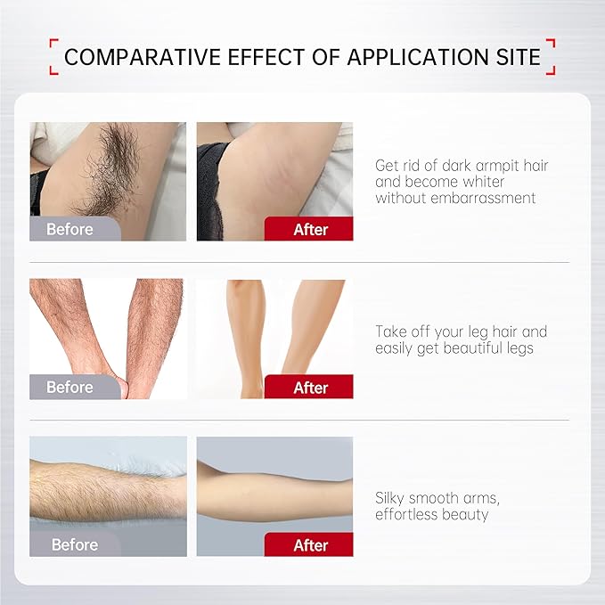 VGO 2 Pack Painless Hair Removal Cream for Women & Men, Hair removal cream for body, back & legs, Depilatory Cream Suitable All Skin Types