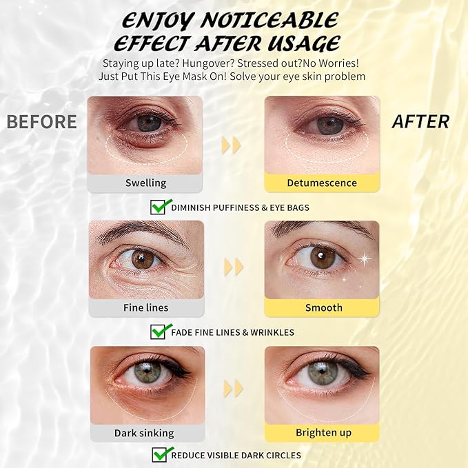 Under Eye Patches Variety Pack (8 Pairs), Eye Masks for Dark Circles Puffy Eyes Undereye Bags With 8 Colors (1 Pairs/Color), Vegan Eye Skin Care Set for Bachelorette Party Favors