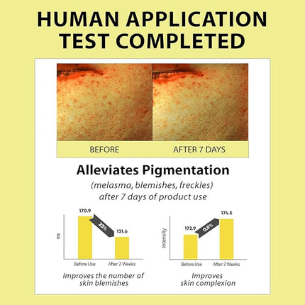 AMPLE:N Blemi Shot Serum – 7 Days Dark Spot Corrector Remover Serum for Face – F or a Brighter & Appearance – Diminishes Dark Spots & Visibly Firms – Niacinamide & Vitamin C, 1.69 fl.oz.