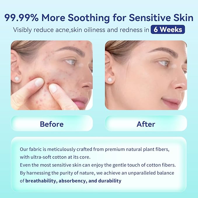 Disposable Face Towels,Ultra Thick Face Towelettes XL, Lint-Free Facial Wipes for Makeup Removal,10"×12", 300 Count (6 Pack),Pearl-textured