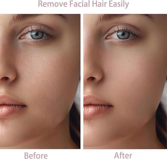 Women Facial Hair Removal Device Battery Operated with 2 Replacement Heads,Ladies Face Shaver for Peach Fuzz Upper Lip,Chin,Facial Hair Removal for Women