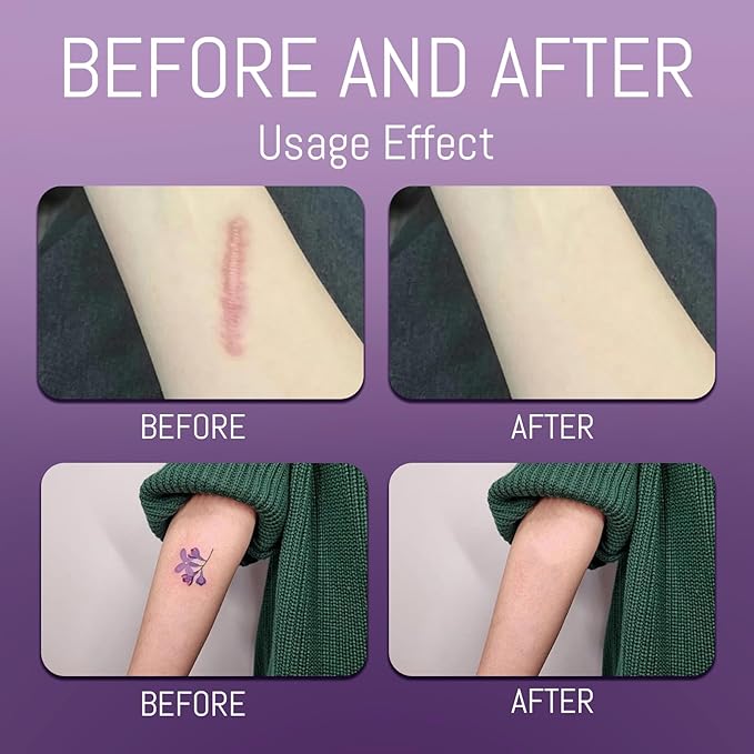 Body Coverage Perfector - Waterproof Leg & Body Makeup, Tattoo Cover Up, Natural Radiance, Sweatproof & Transfer-Resistant (01)