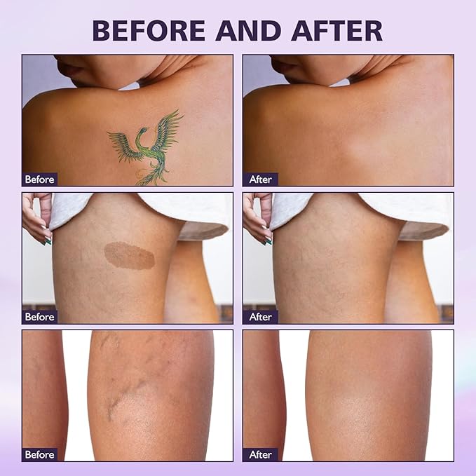 Body Coverage Perfector Waterproof, All Over Complexion Perfector,Long Lasting, Waterproof, Tattoo Cover Up Makeup Waterproof No Transfer, Tattoo Cover Up Makeup Waterproof (2.5OZ-2PC)