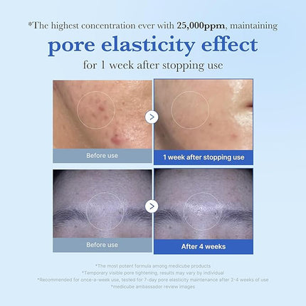 medicube Exosome Shot Zero 25,000 PPM Spicule Facial Serum | Liquid Skin Booster Serum | Exosome, AHA+BHA+PHA | Pore Care, Dead Skin Cells, Skin Texture | Korean Skincare, 0.43 fl.oz