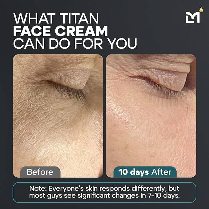 Titan Anti-Aging Mens Face Cream – Mens Face Moisturizer – For Men, Face Lotion – Men, Skin Care – Tighten, Tone, Revitalize – Ceramides, Vitamin C & E, Squalane – All Skin Types – Unscented