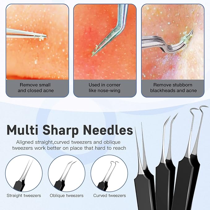 Professional Pimple Popper Tool Kit,10 PCS Blackhead Remover Tweezers,Extractor Acne Removal Kit for Easy Removal for Pimples,Comedone Extractor Tools for Removing Zit,Acne Removal Kit (Black)
