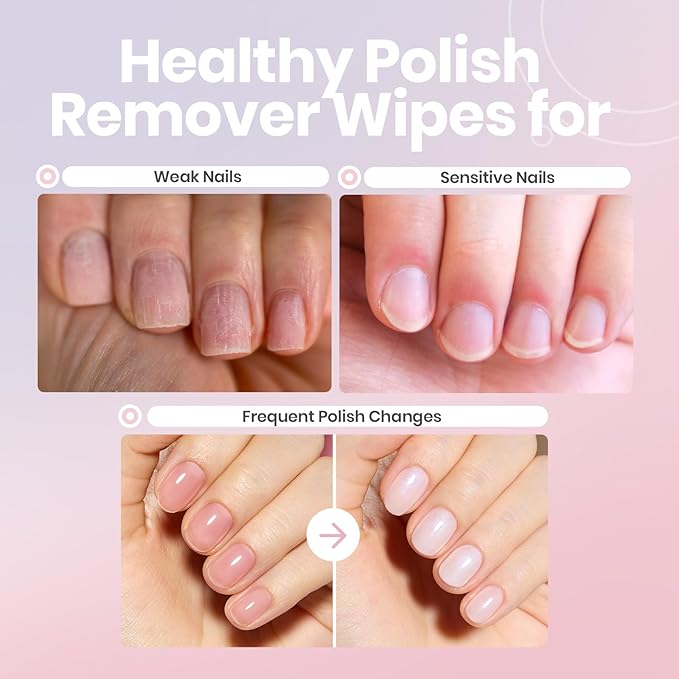 Beetles Nail Polish Remover Pads - 100 Count Nail Wipes 2-in-1 Prep & Lacquer Remover Nail Scrubbers Travel-Friendly Fingernail Polish Remover with vitamin E