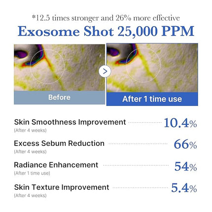 medicube Exosome Shot Zero 25,000 PPM Spicule Facial Serum | Liquid Skin Booster Serum | Exosome, AHA+BHA+PHA | Pore Care, Dead Skin Cells, Skin Texture | Korean Skincare, 0.43 fl.oz