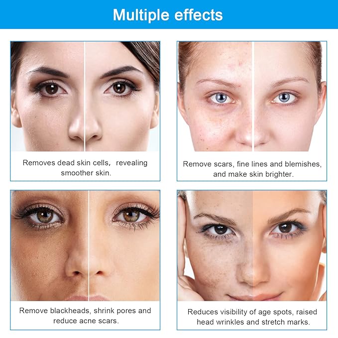 Diamond Microdermabrasion Machine Professional Dermabrasion Machine Facial Care Salon Equipment for Vacuum Blackhead Removal