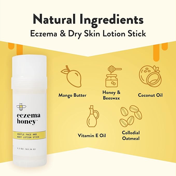 ECZEMA HONEY Gentle Face & Body Lotion Stick - Moisturizing Colloidal Oatmeal Hand Cream for Extremely Dry Skin - Eczema Lotion Helps Psoriasis, Dermatitis & More (2.2 Oz)