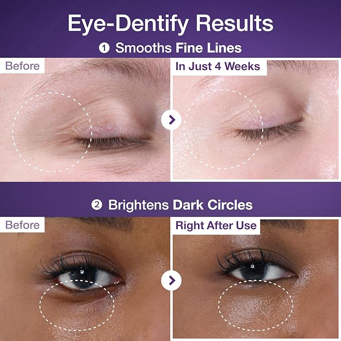 numbuzin No.9 Eye Cream | NAD+ Retinol Volumetox Eye Cream | Firming, Wrinkles, Fine Lines, Dark Circles, Puffy | Retinol, Peptides, Niacinamide | Undereye Treatment Serum | 0.33 fl. oz.