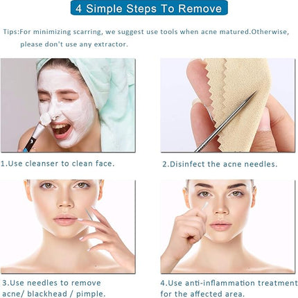 5PCS Blackhead Remover Comedone Extractor, Curved Blackhead Tweezers Kit, Professional Stainless Pimple Acne Blemish Removal Tools Kit for Manual