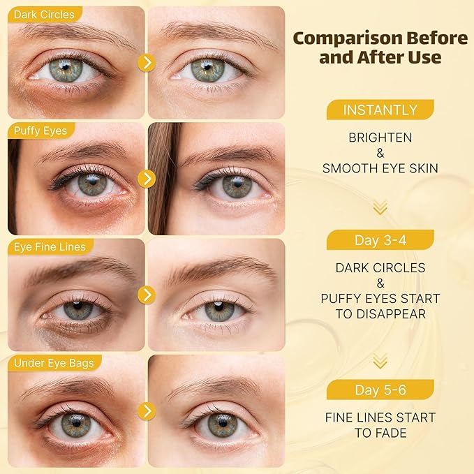 Under Eye Patches - Eye Masks for Dark Circles and Puffiness (20 Pairs) Collagen Eye Patches for Moisturizing & anti wrinkle, Under Eye Masks with Hyaluronic Acid & Niacinamide