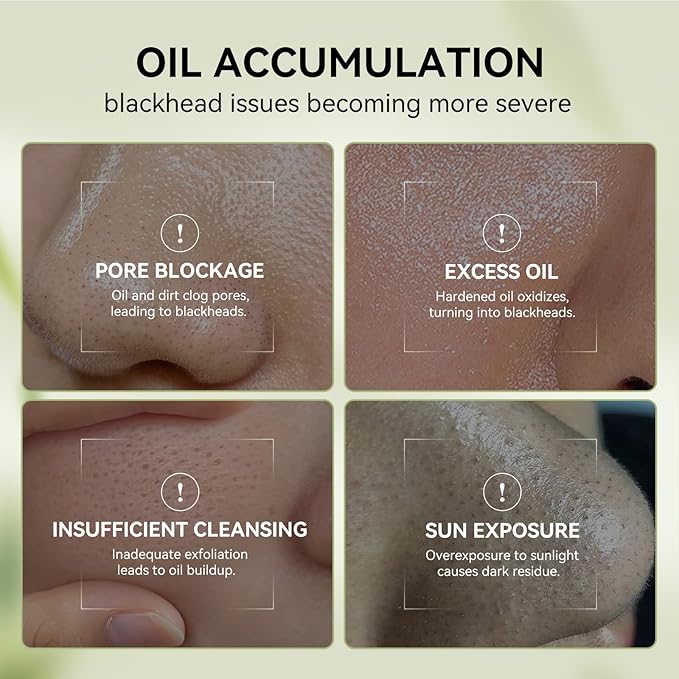 LANBENA 3-in-1 Blackhead Removal Set - Bamboo Charcoal Pore Strips (30g), Pore Minimizing Serum (30ml) & Removal Paper - Mask for Face, Minimizes Pores & Leaves Skin Fresh & Clean, Blackhead Remover