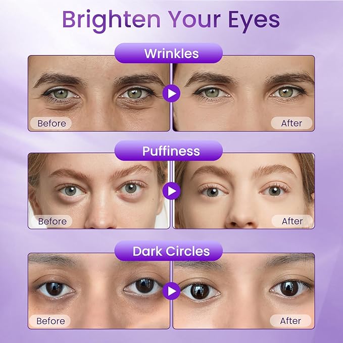 Retinol Eye Cream – Retinol and Peptides for Fine Lines, Puffiness, and Under-Eye Shadows, Anti Aging Eye Cream, Eye Care Daily Wrinkle Cream