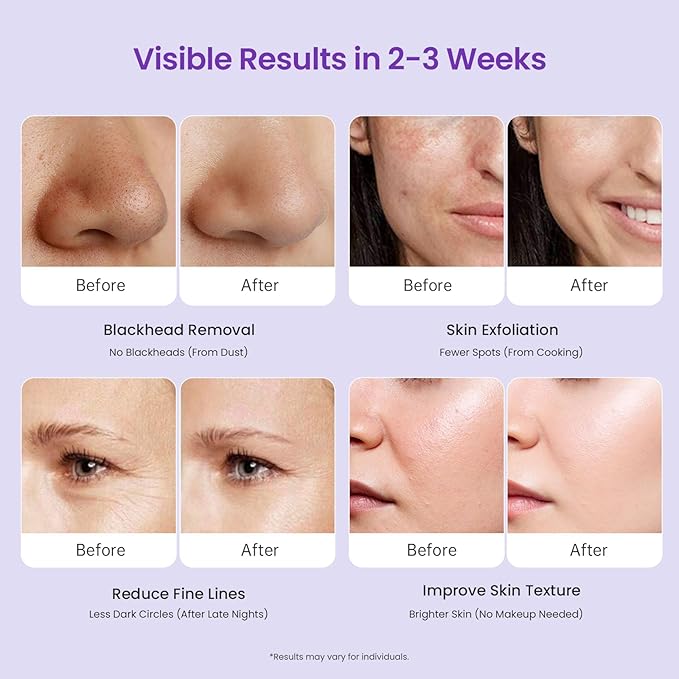 Diamond Microdermabrasion Machine Professional, 3 in 1 Dermabrasion Facial Peeling Skin Care Device for Salon Personal Home Use