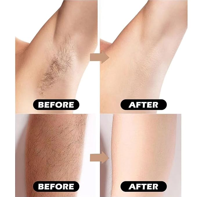 Razors for Women Sensitive Skin，6 blade Lady Shaving Razor for Women, Women’s razors for Shaving Including 1 Travel Razors for Women with 19 Blade Refills