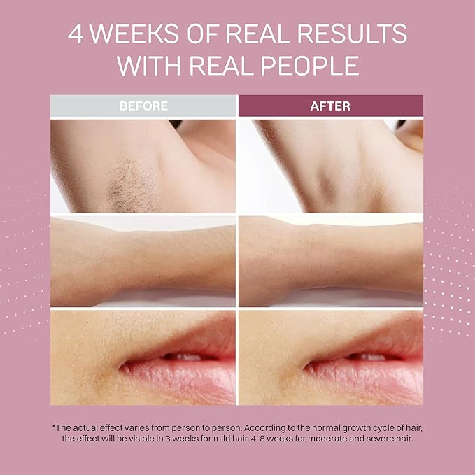 IPL Hair Removal Device for Women & Men – Laser Hair Remover Machine for Body, Legs & Armpits – Painless Handheld Shaver